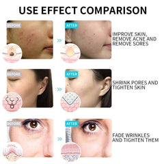 Facial Mask Machine with Massage and Skincare Features